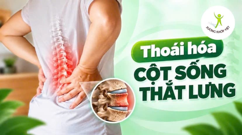 Thoái hóa cột sống thắt lưng: Nguyên nhân, dấu hiệu và cách phòng ngừa